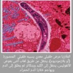 حول الاصابة بمرض الملاريا في العراق، الصحة العراقية توضح